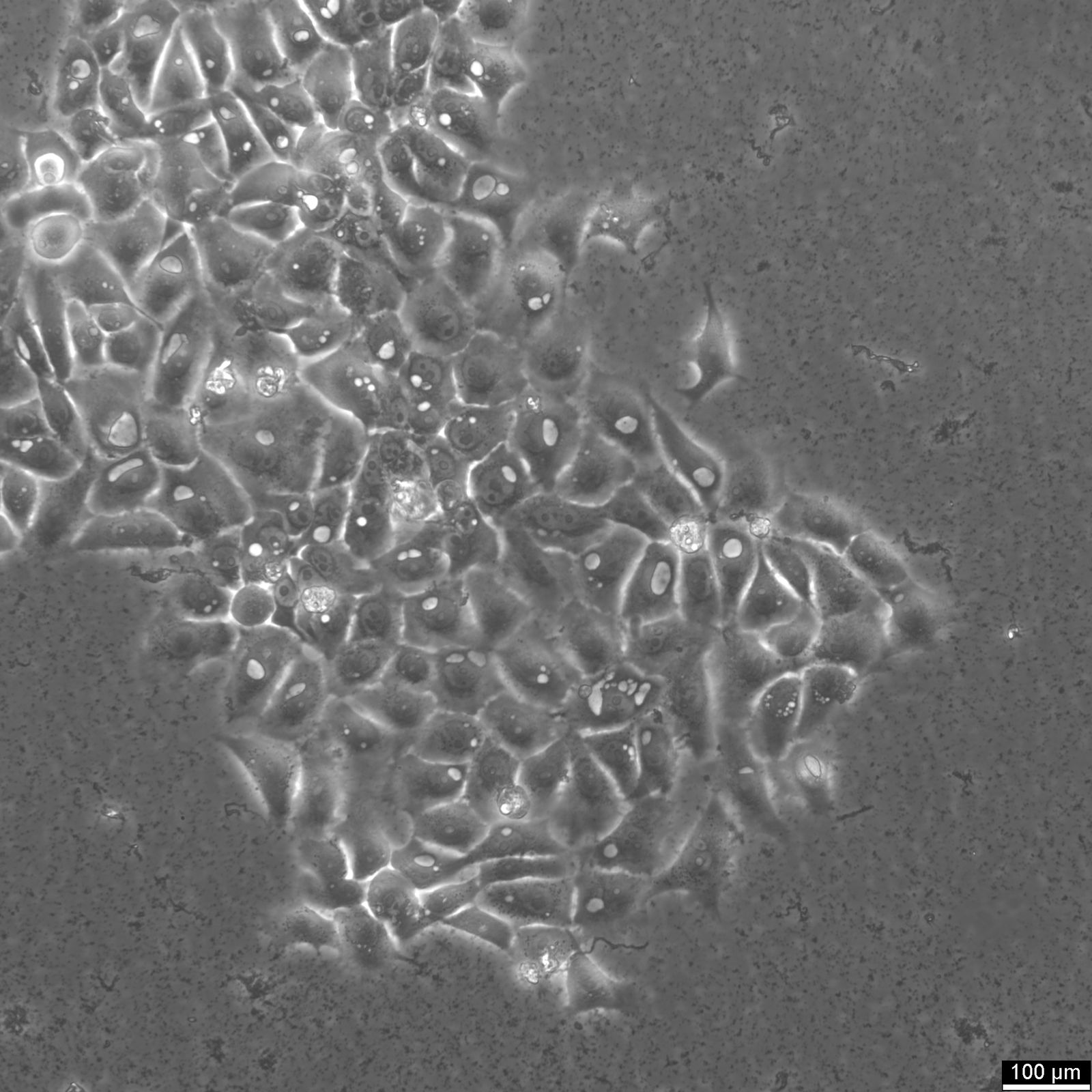 BEAS 2B Cells