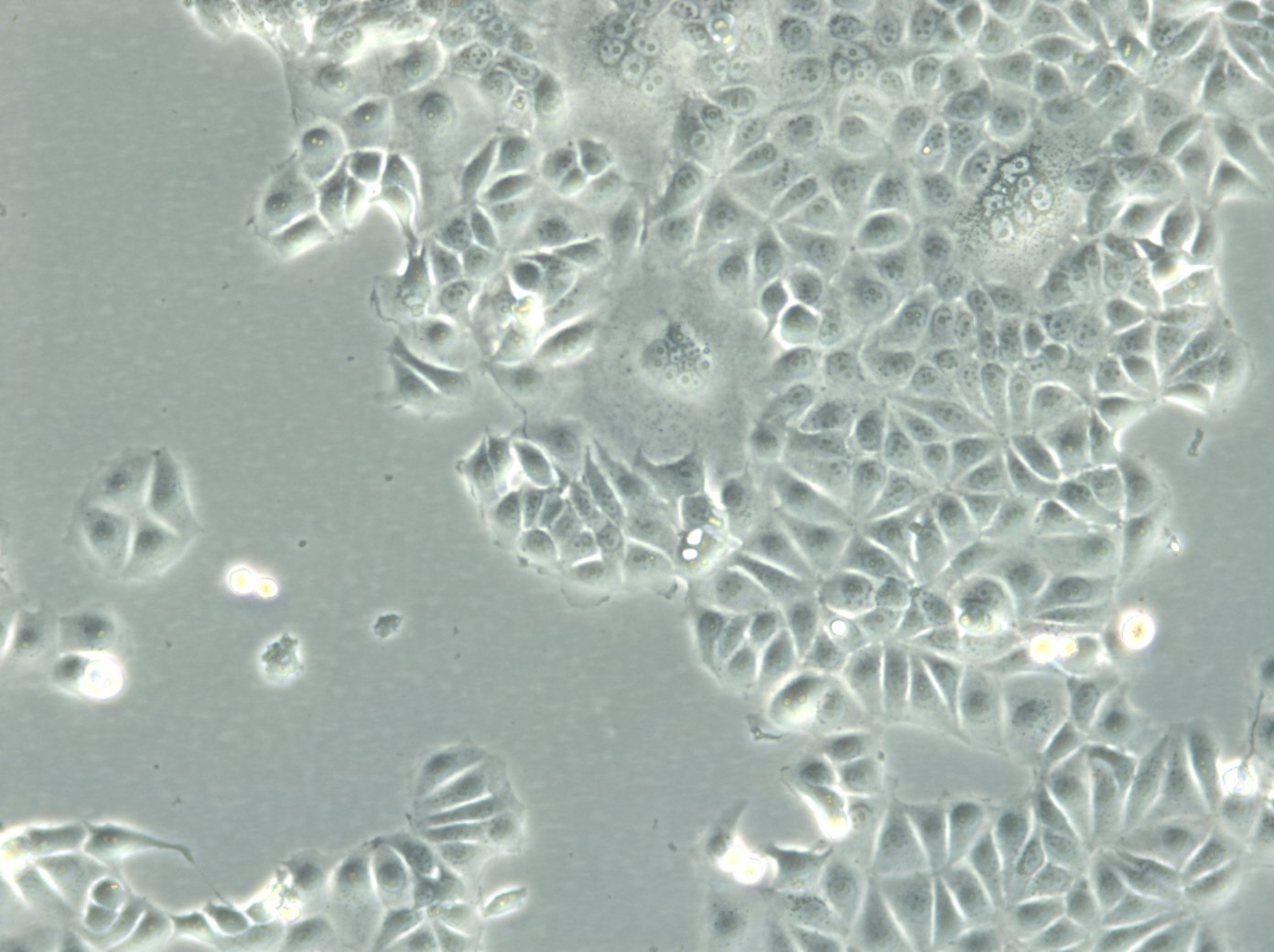 MCF-7-Zellen