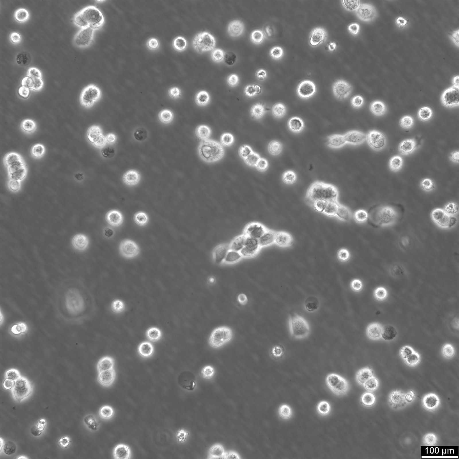 NCI-H358-Zellen