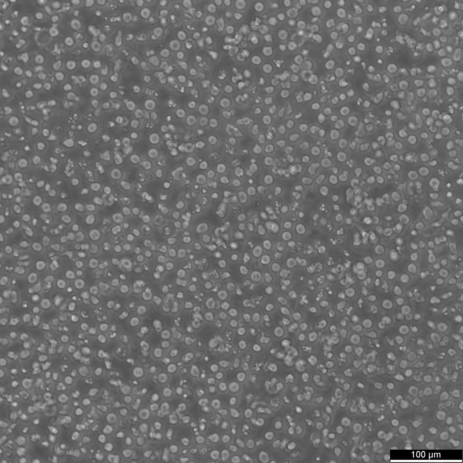SKW-3 Cells SKW-3 Cells