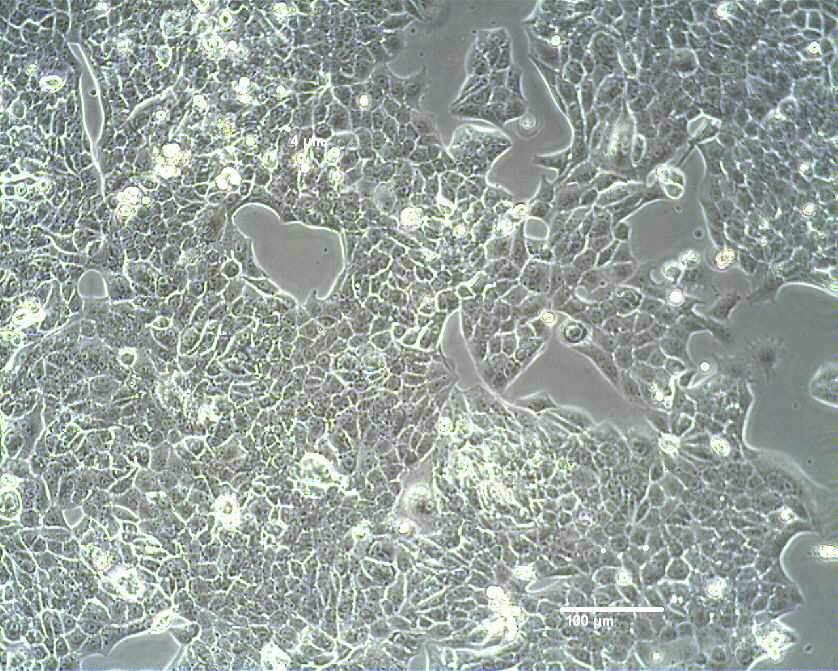RenCa Cells