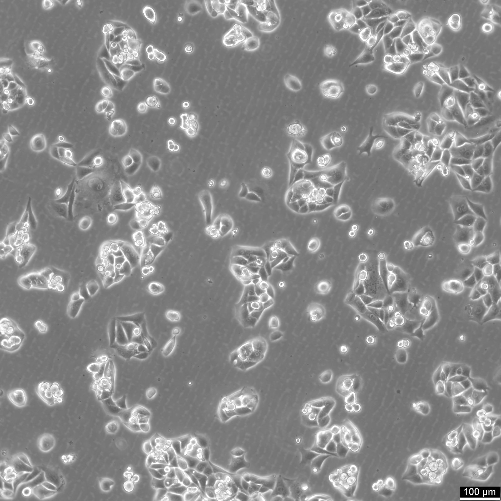 RenCa Cells RenCa Cells