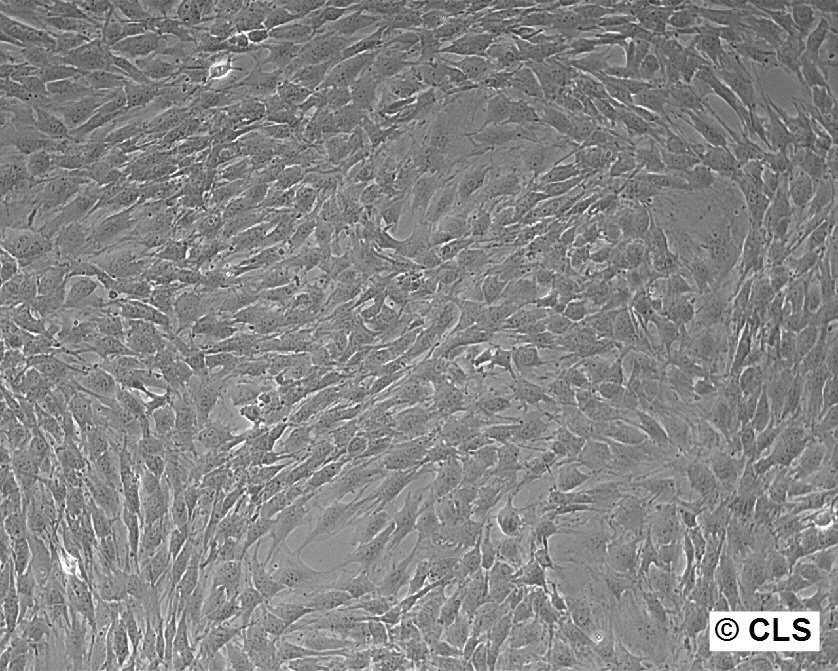 Cellules M2-10B4