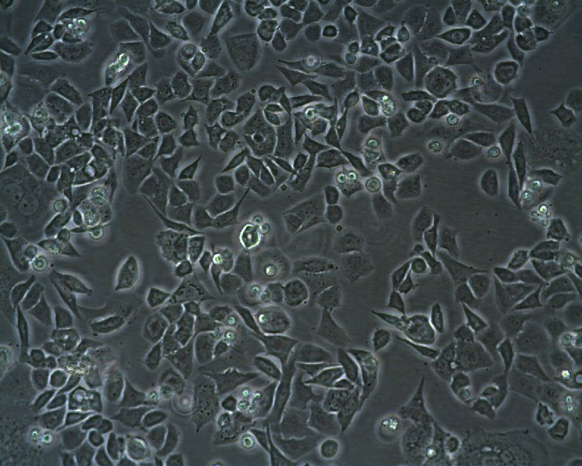 MX-1 Cells