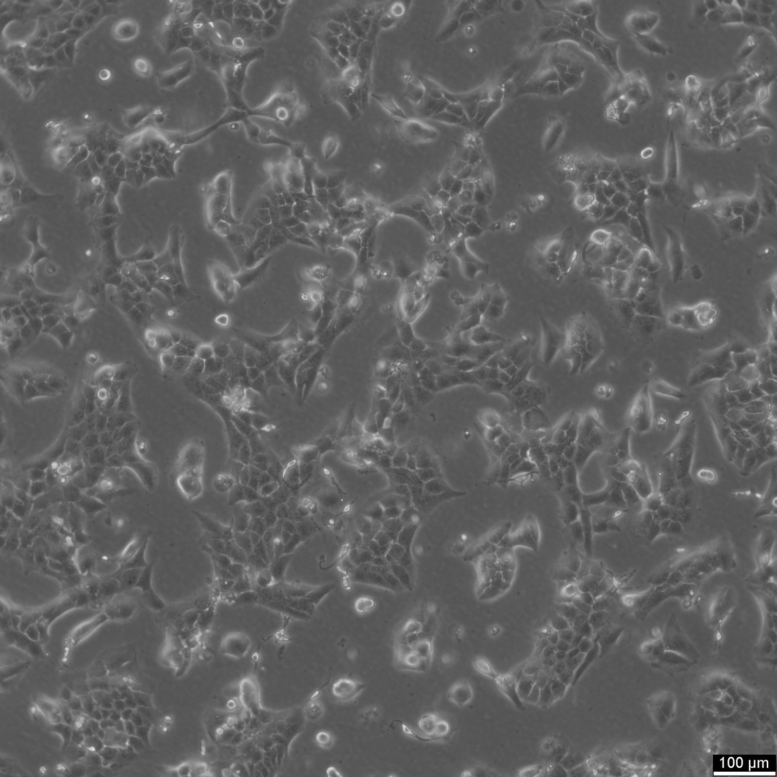 NCI-H2228 Cells NCI-H2228 Cells