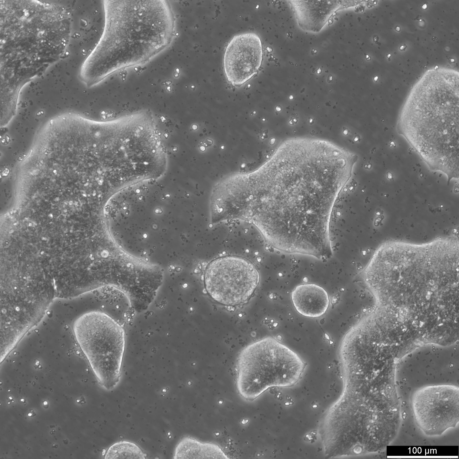 LS174T Cells LS174T Cells