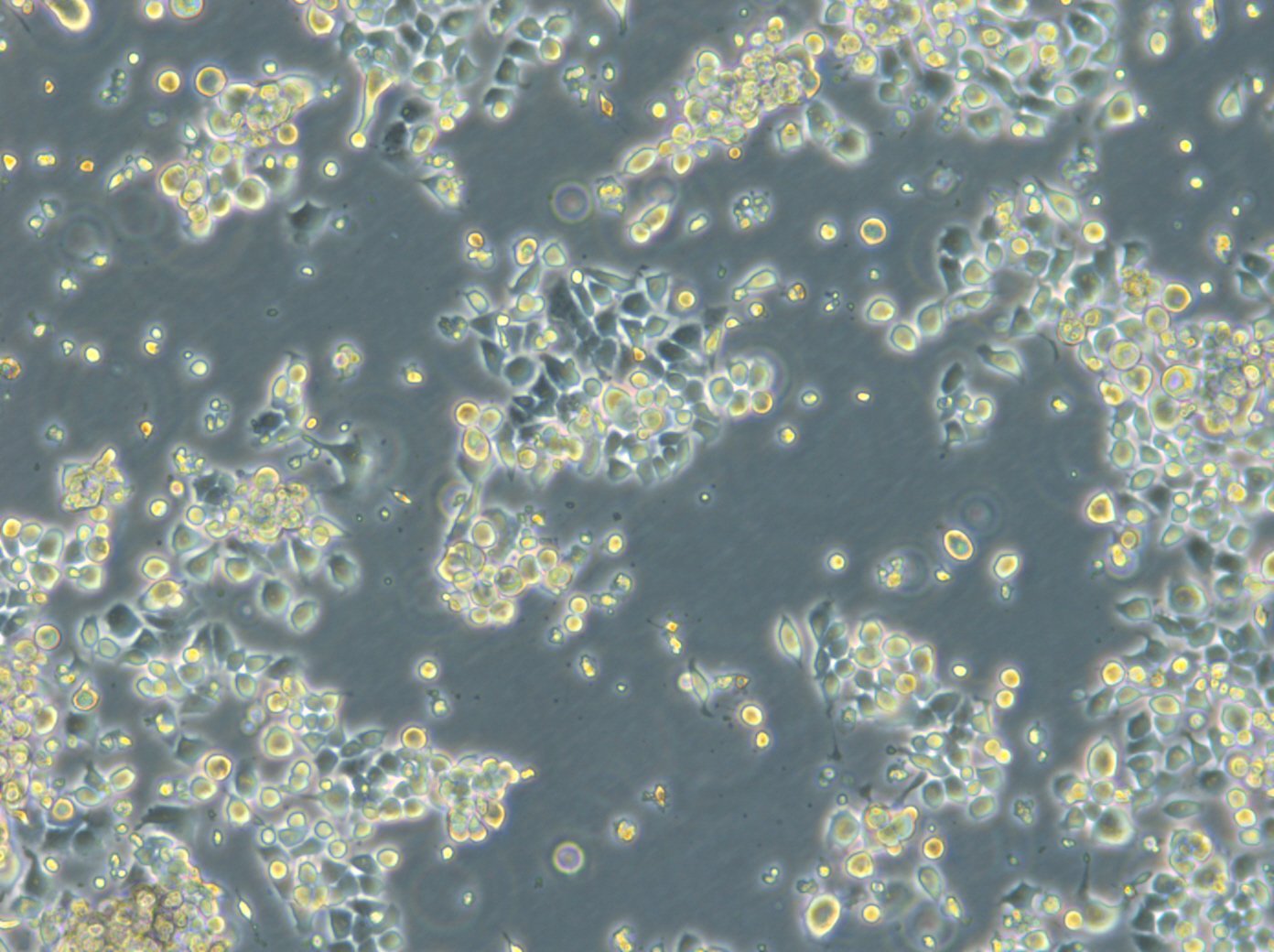HROC87 T0 M2-Zellen