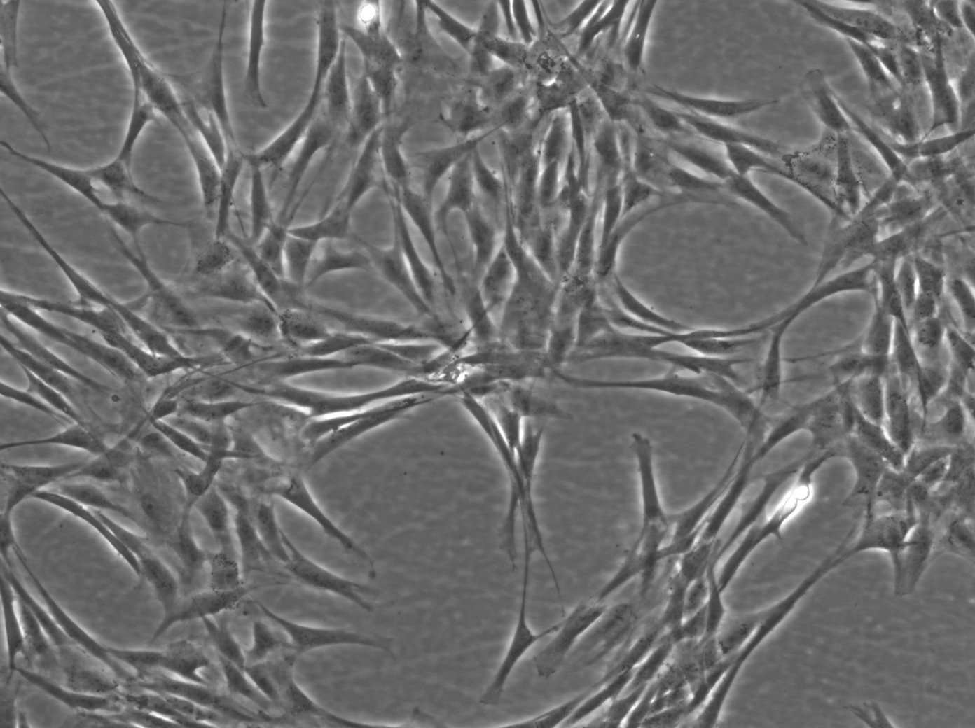Cellules de fibroblastes de peau humaine (HFFC)
