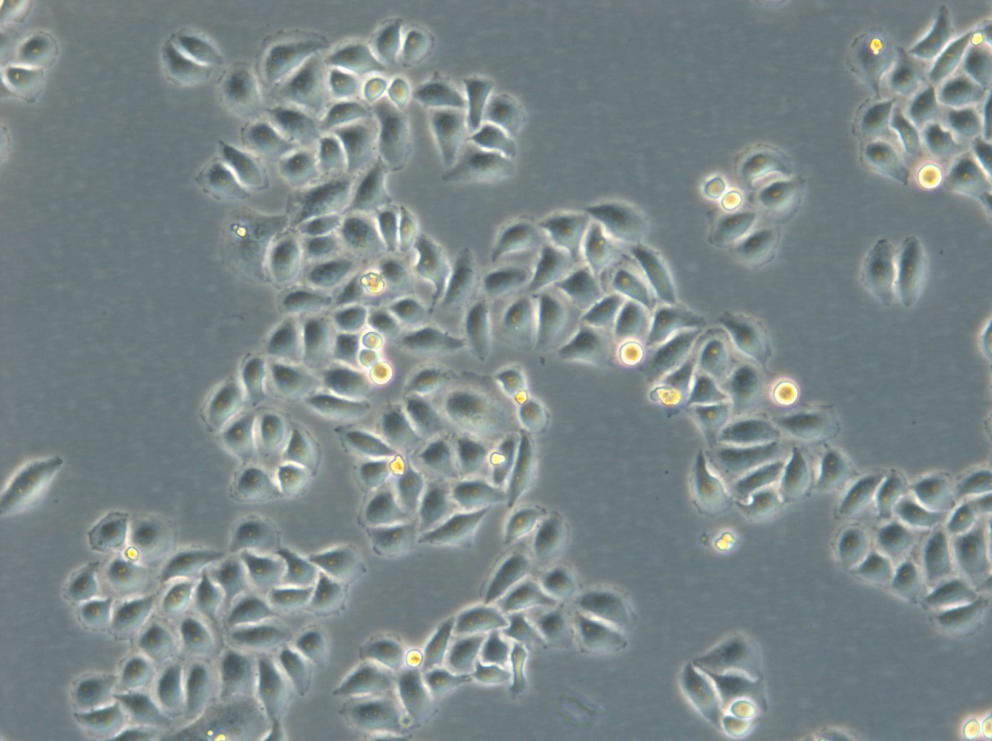 HK-ZFN-AURKB-mEGFP-Zellen