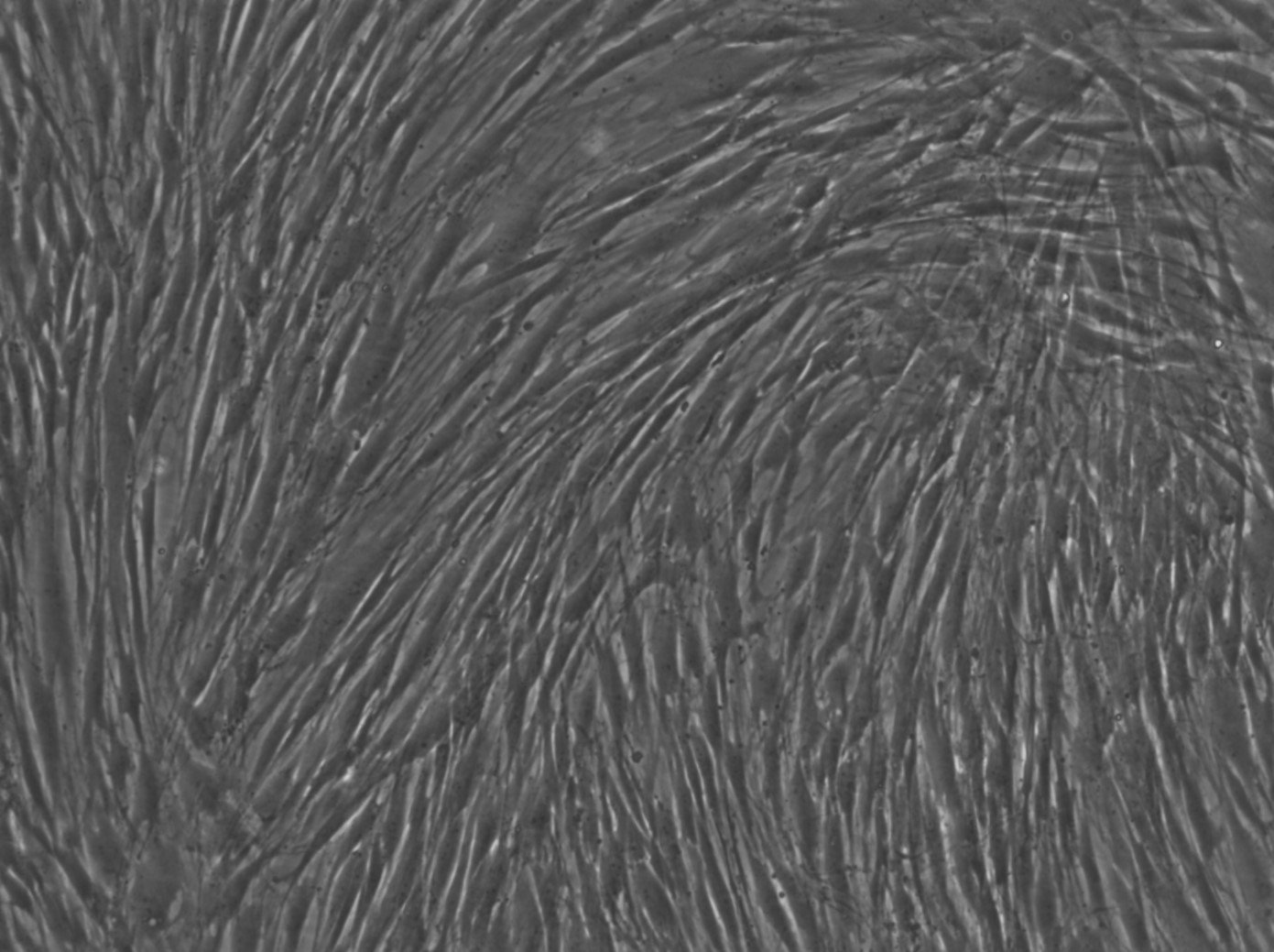 Human Dental Follicle stem Cells (hDFSC) Cells