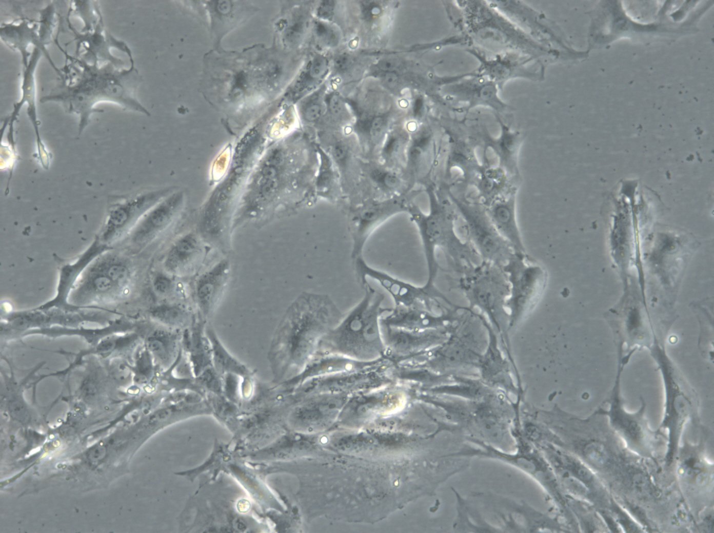 Caki-1 Cells