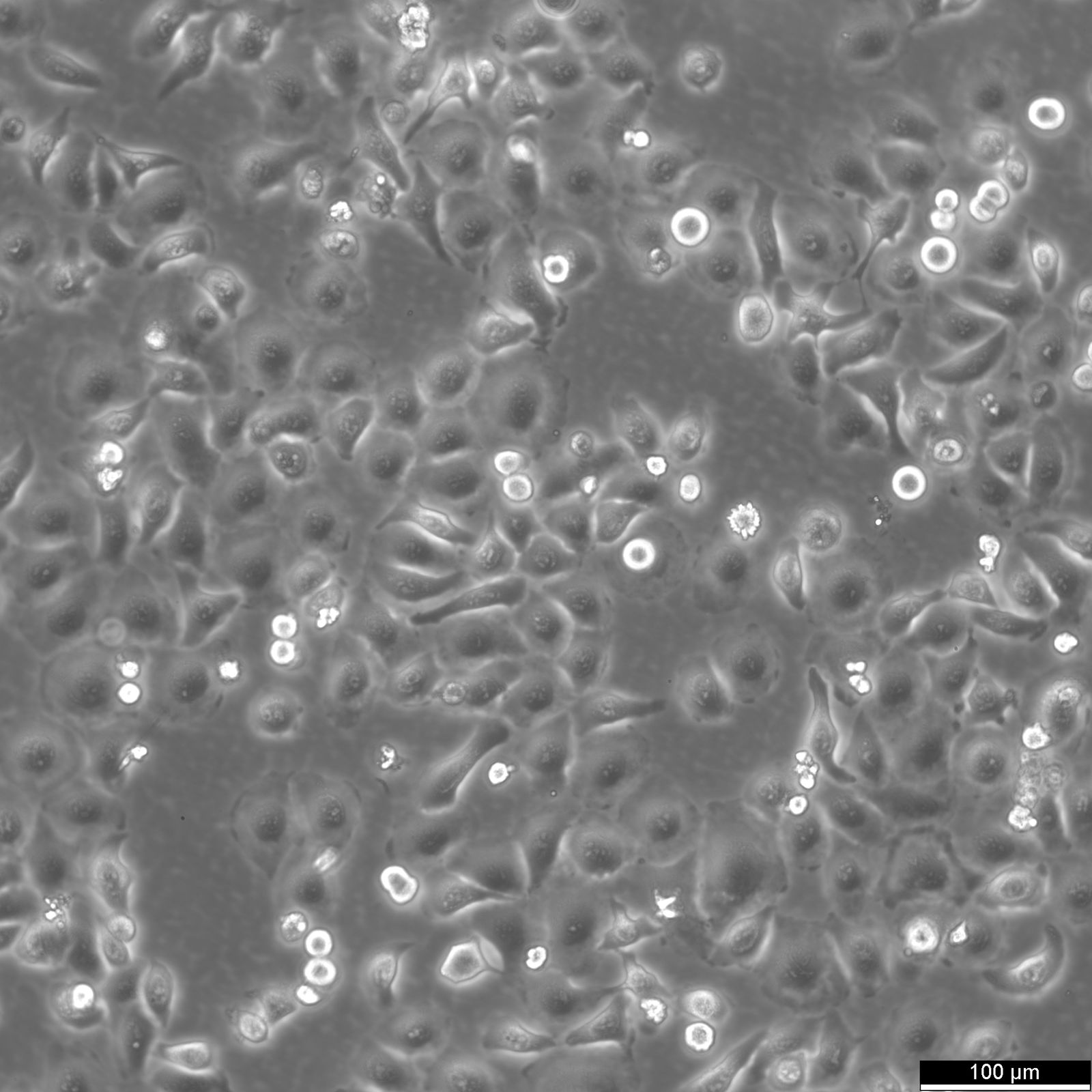 RT-112 Cells RT-112 Cells