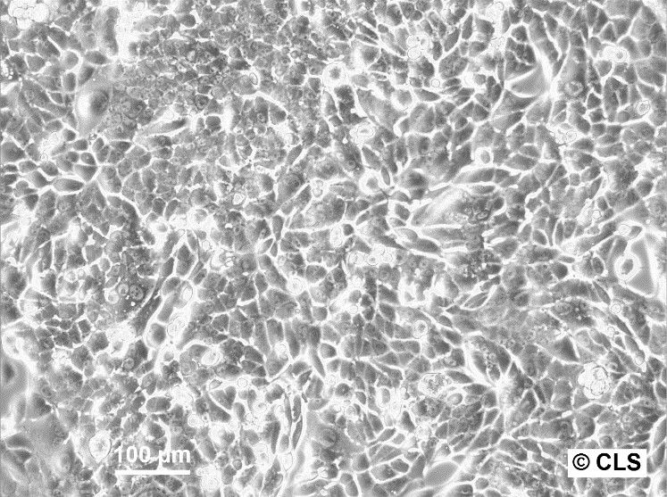 RenCa Cells RenCa Cells