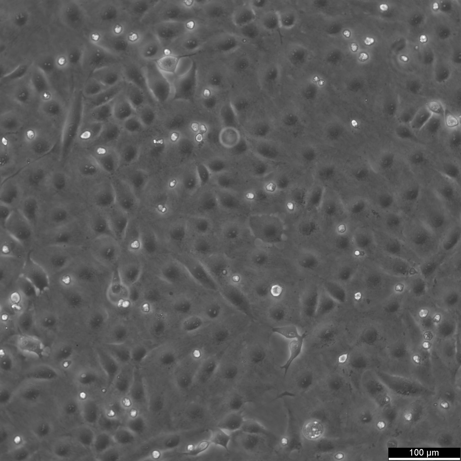 MARC-145 Cells MARC-145 Cells