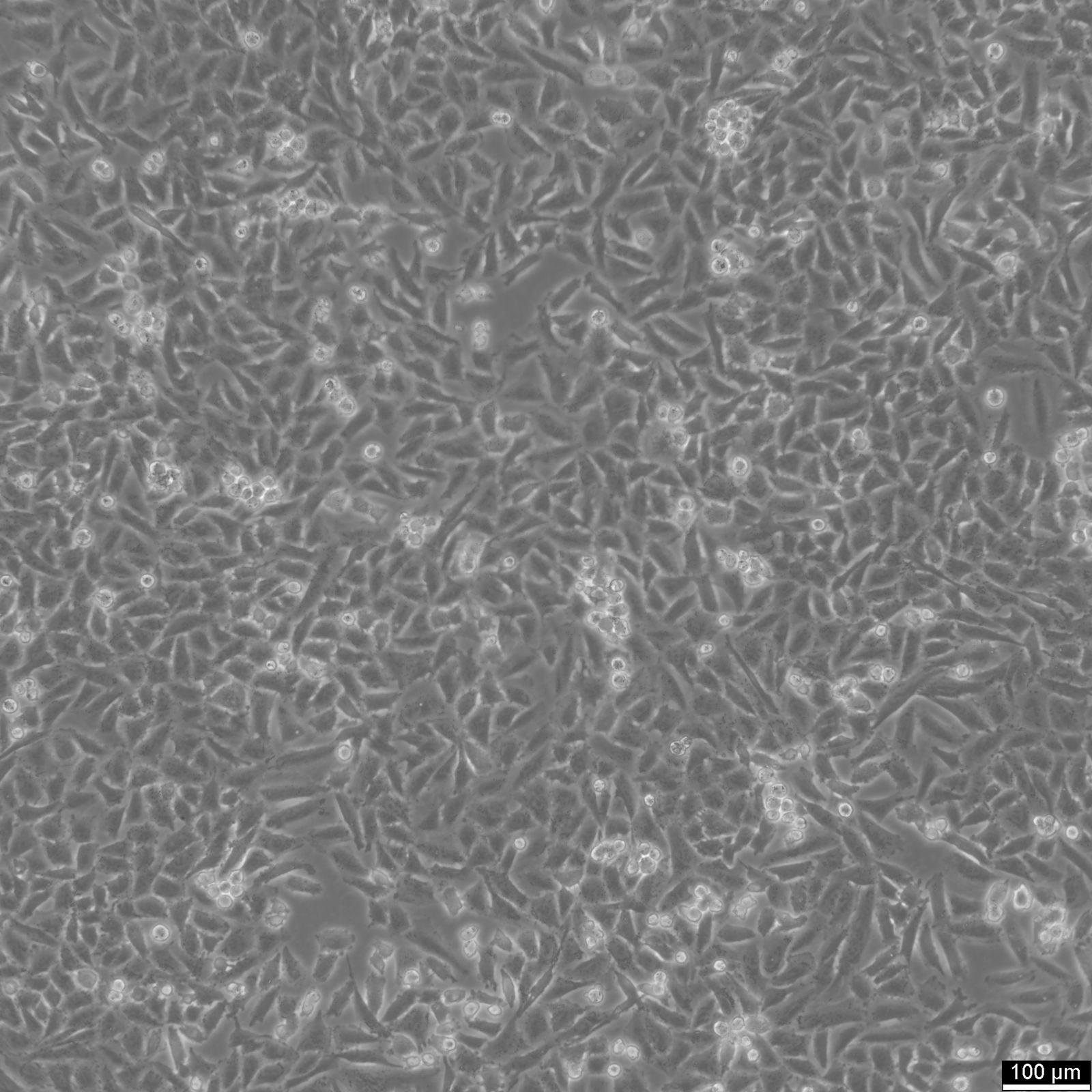 NCI-H1703 Cells NCI-H1703 Cells