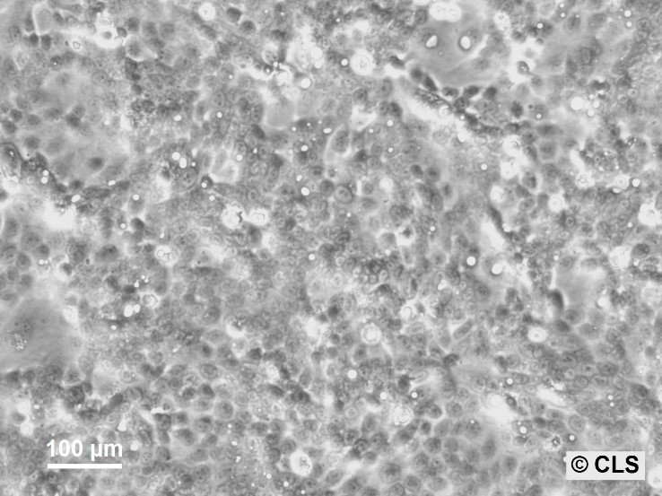 Capan-2-Zellen