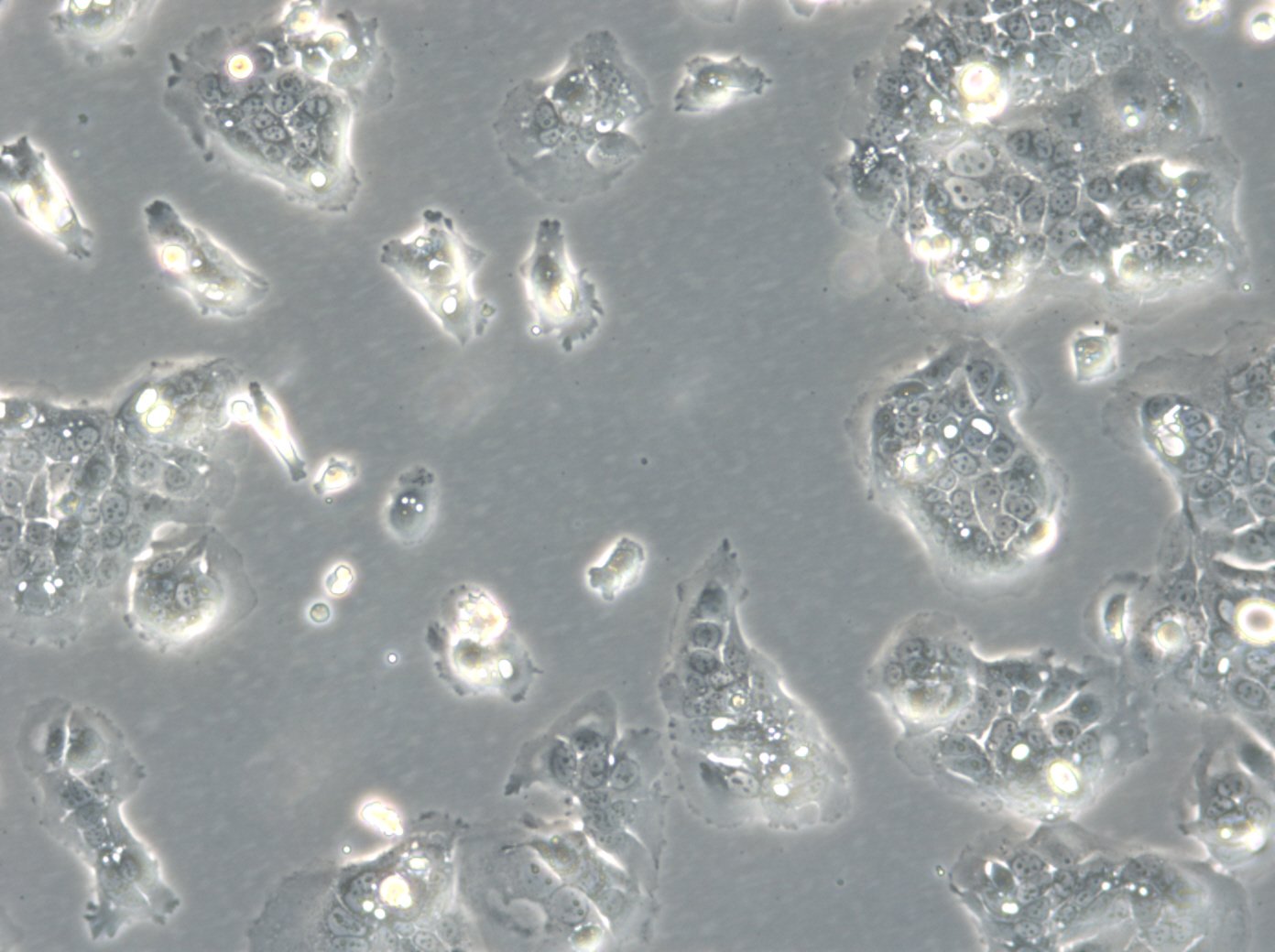 HROC284Met Cells