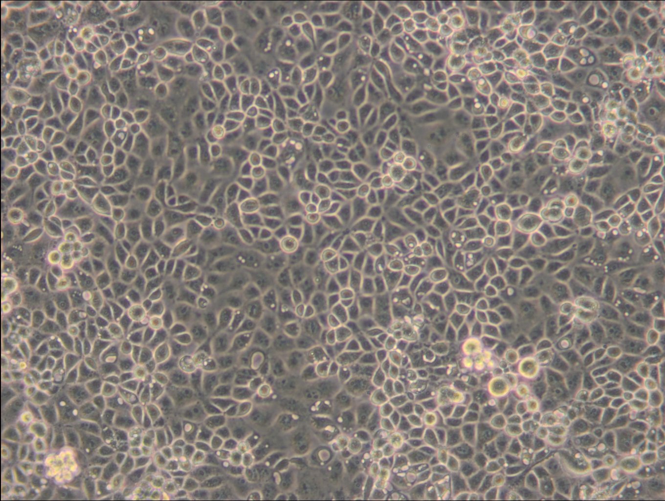 ST-Zellen