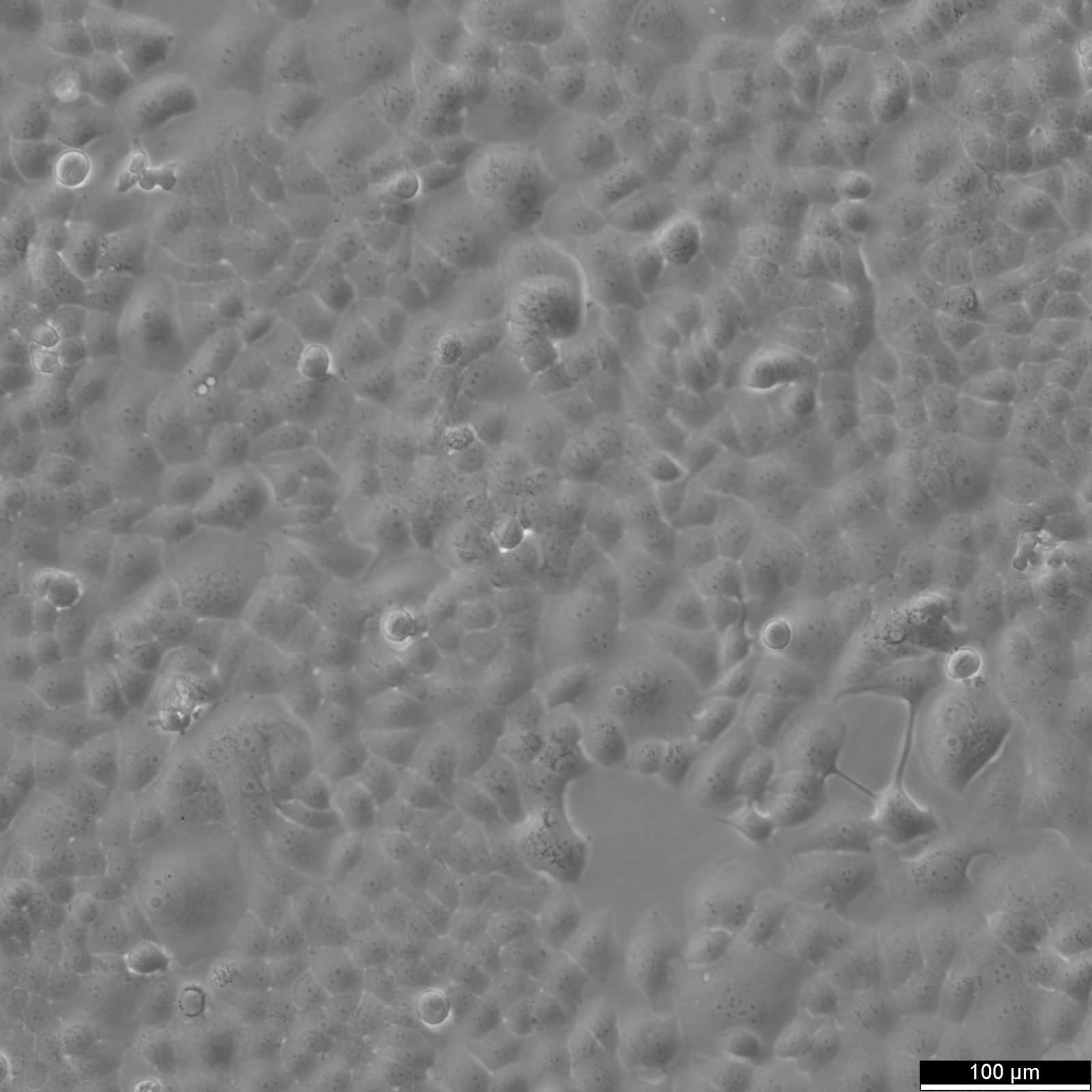 T47D Cells T47D Cells