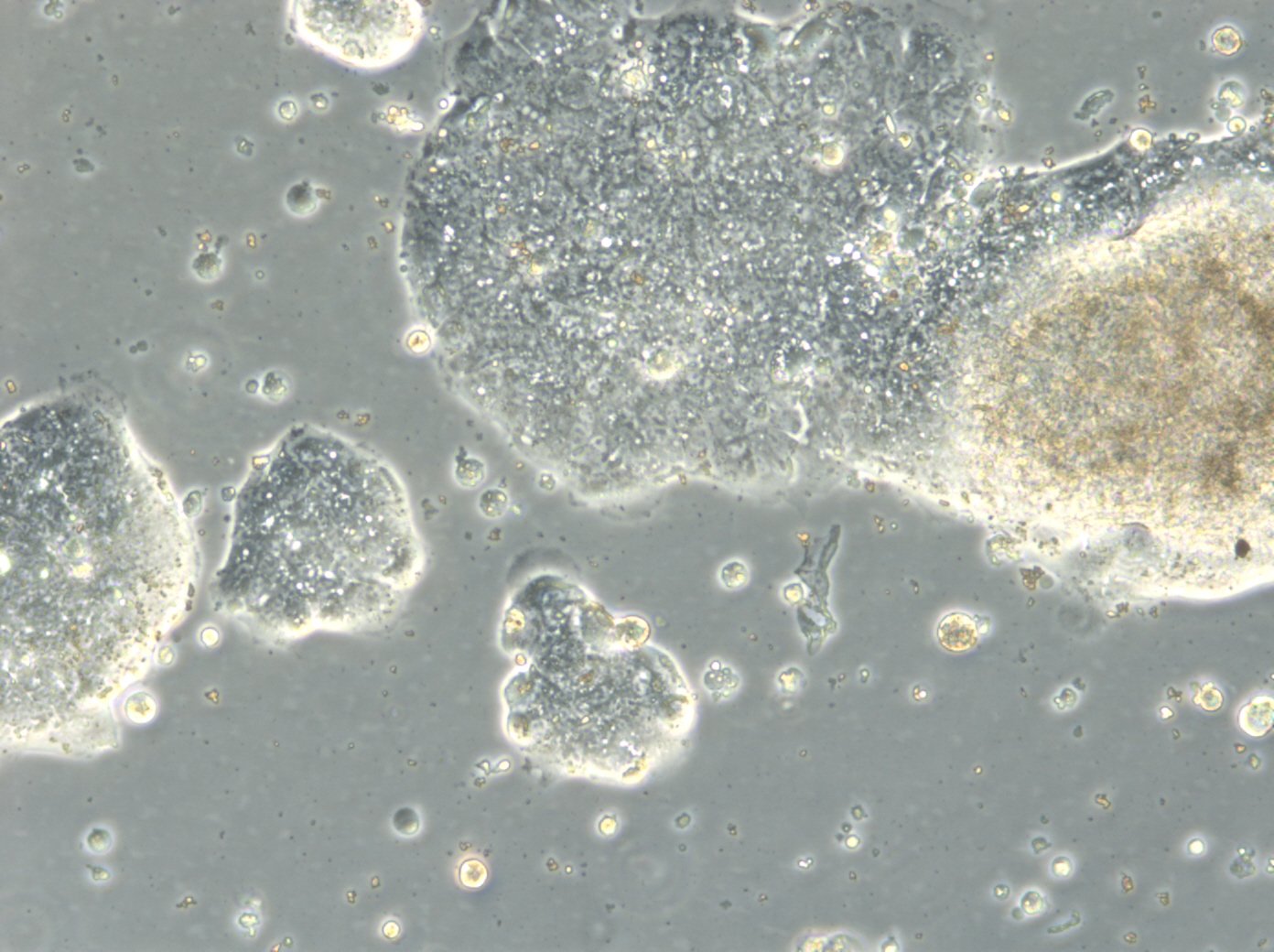 HROC357 Cells