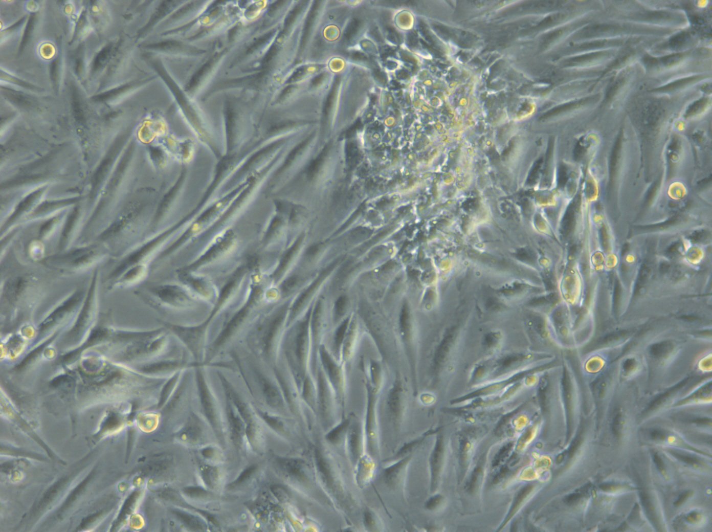 HROG17 T1 M1 Cells