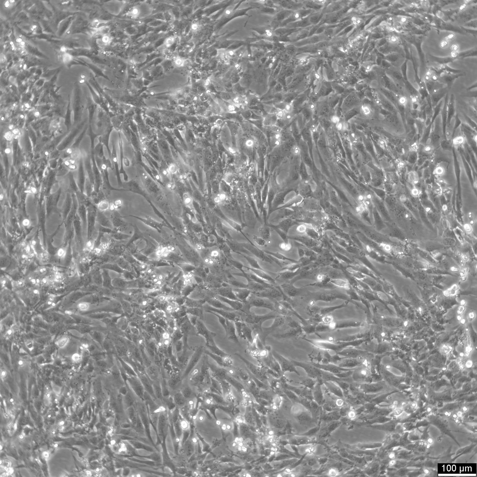 AC16 Cardiomyocyte Cell Line