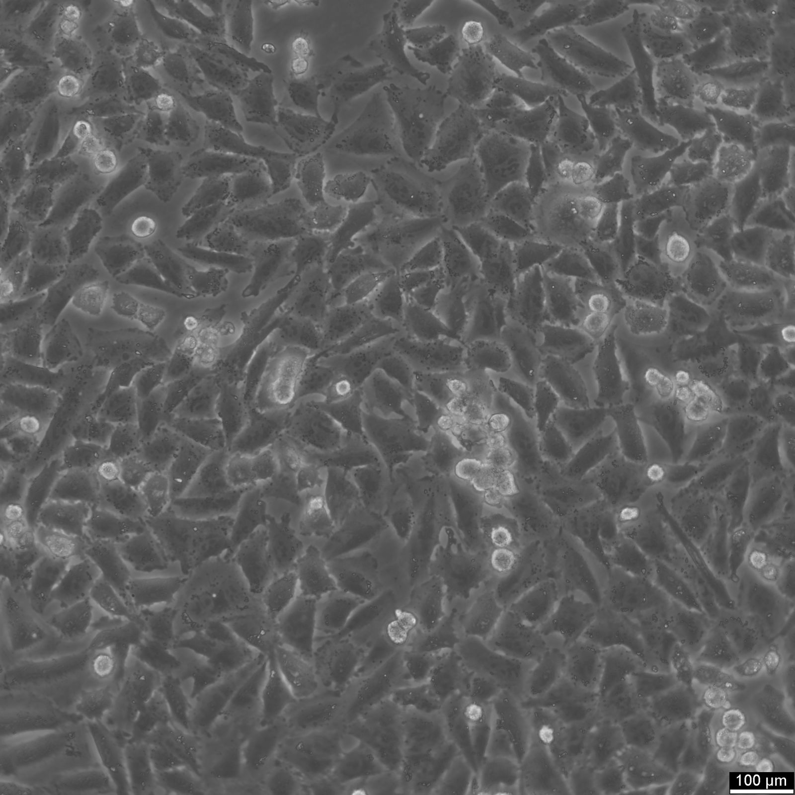 NCI-H1703 Cells NCI-H1703 Cells