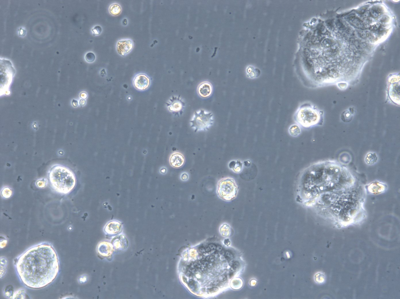HROC46 T0 M1-Zellen