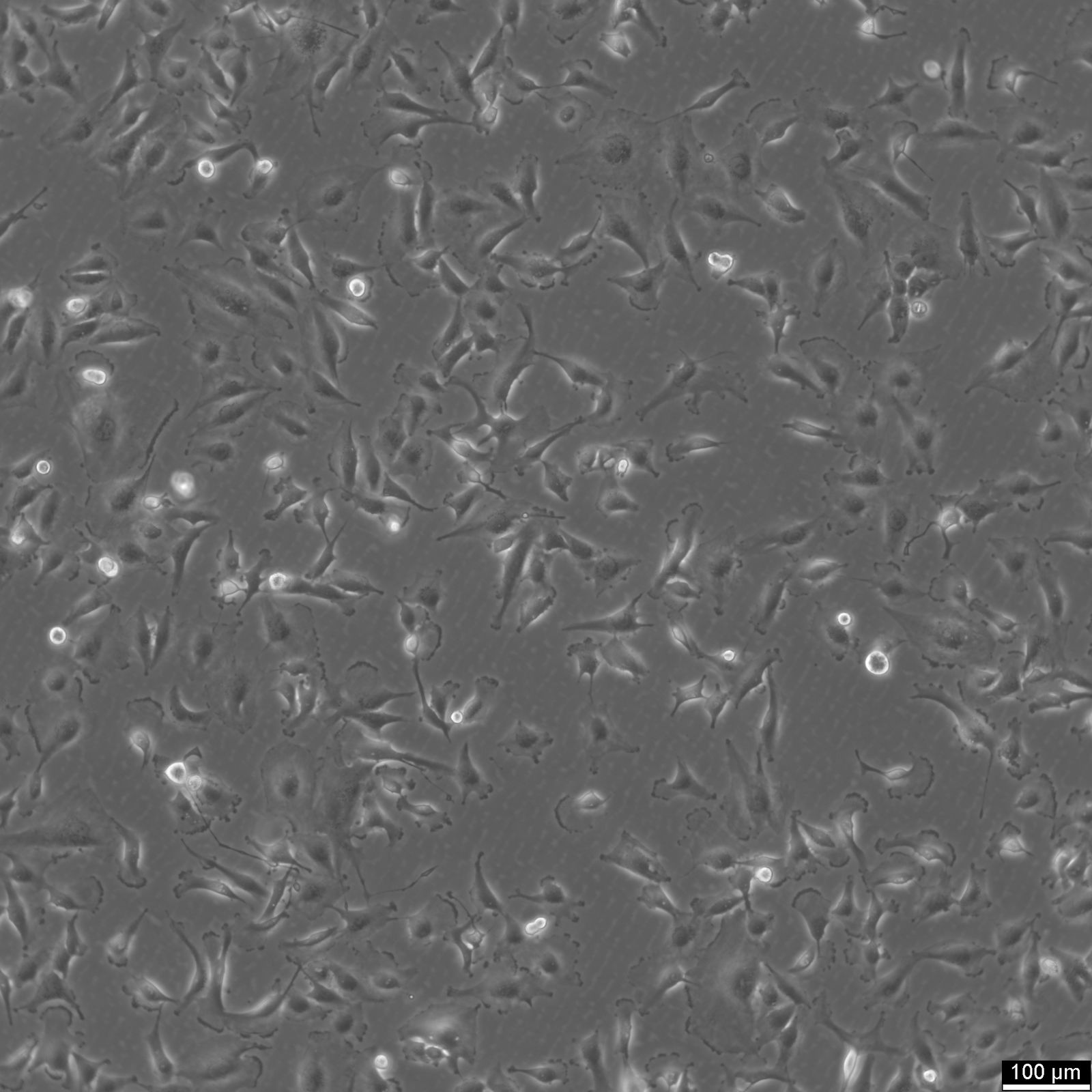 U-251 MG Cells