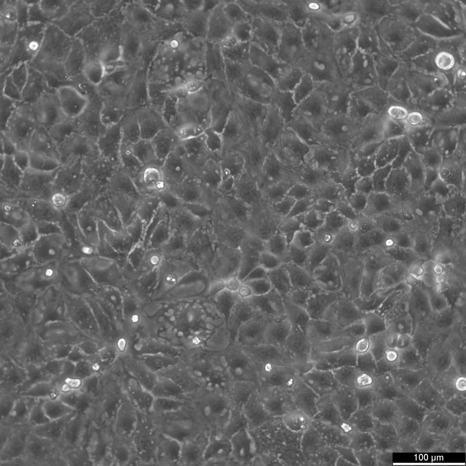 Caco-2 Cells Caco-2 Cells