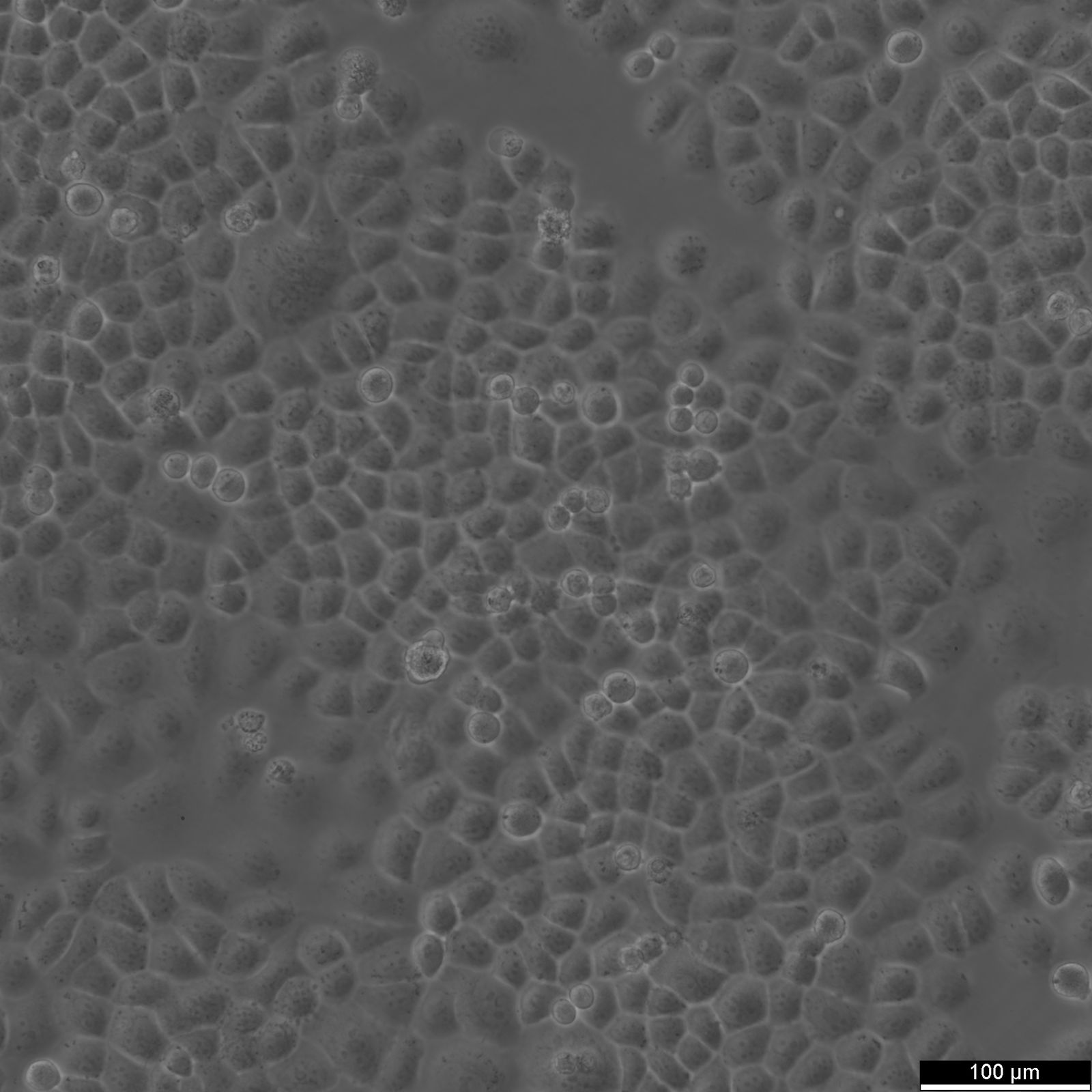 SW-13 Cells SW-13 Cells