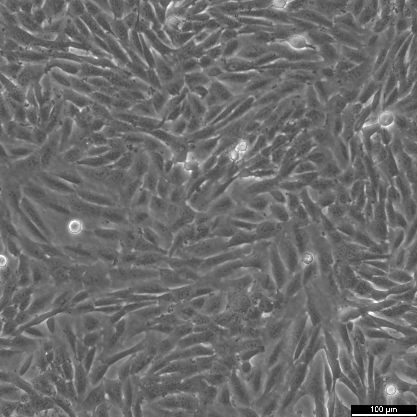 SUM159PT Cells