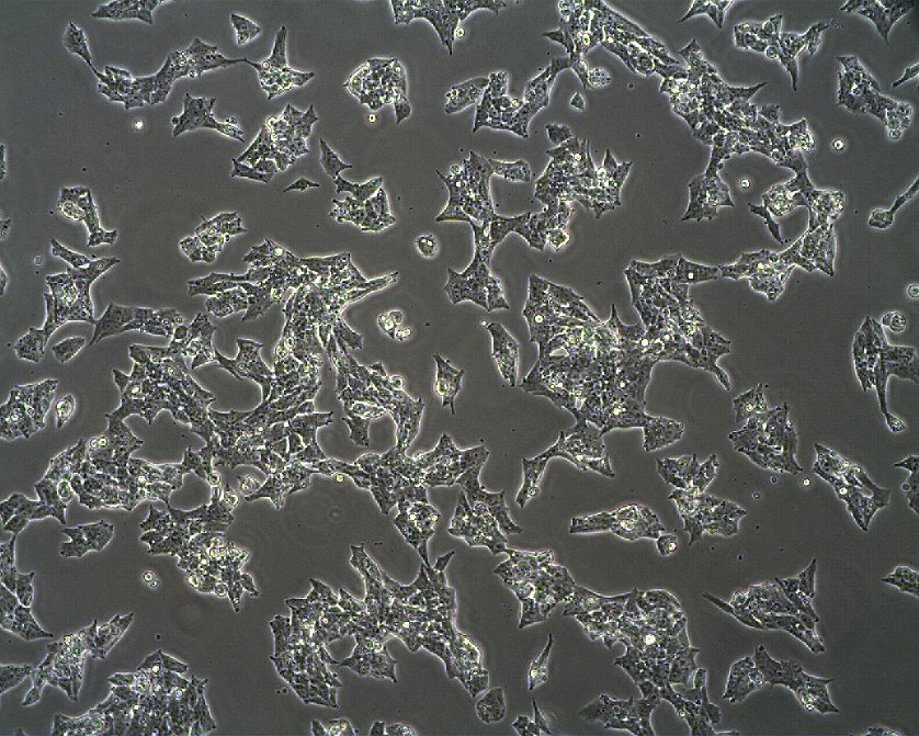 NCI-H295R Cells
