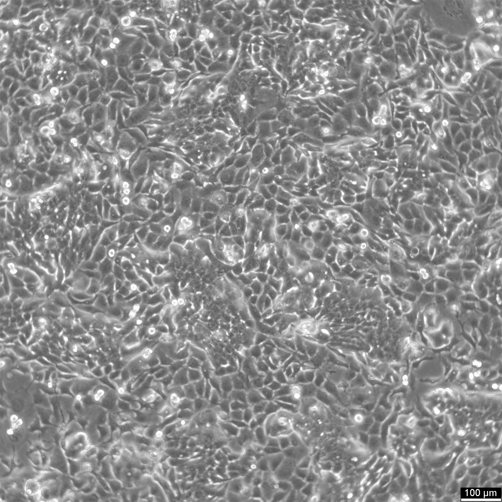 Cellules NCI-H358
