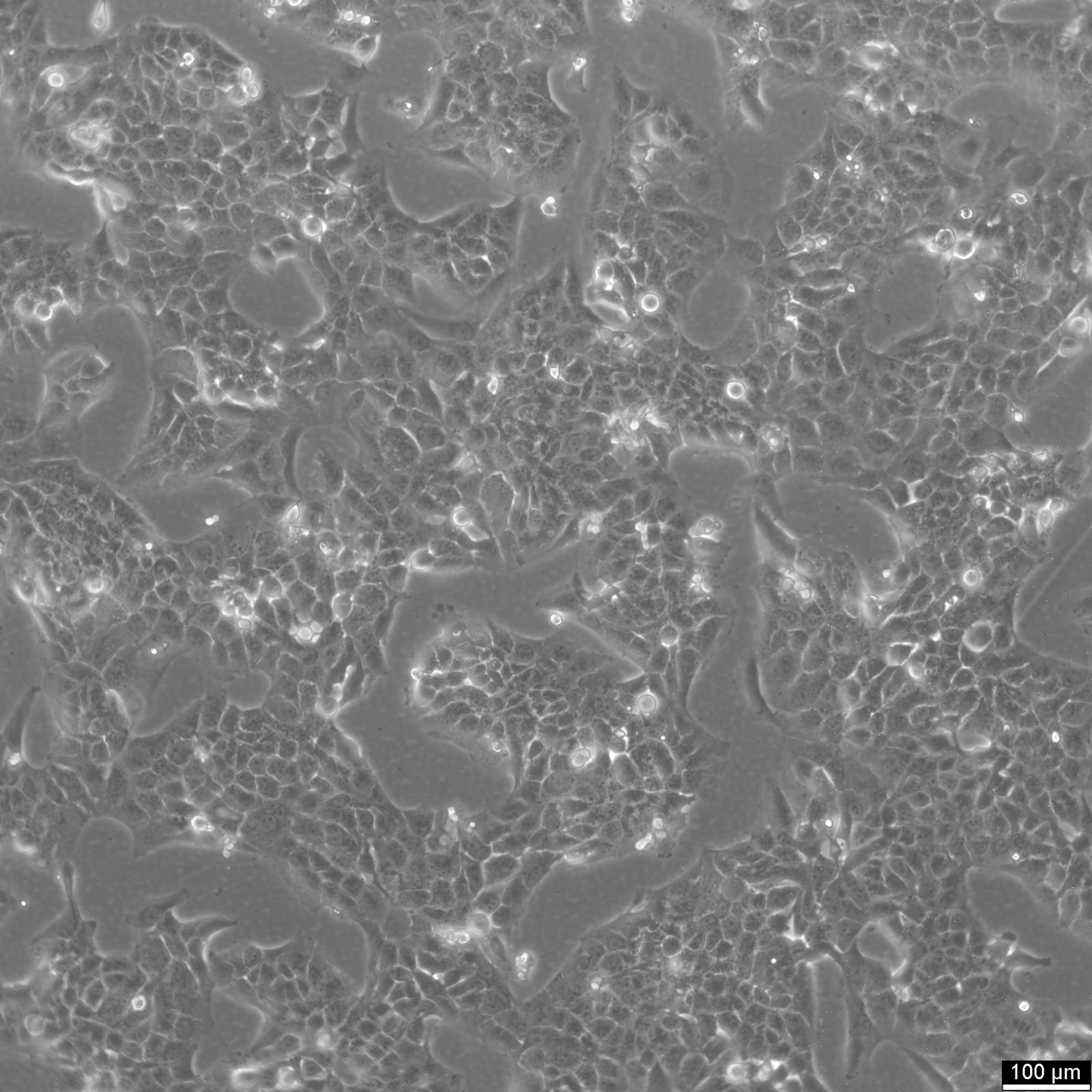 NCI-H2228 Cells NCI-H2228 Cells