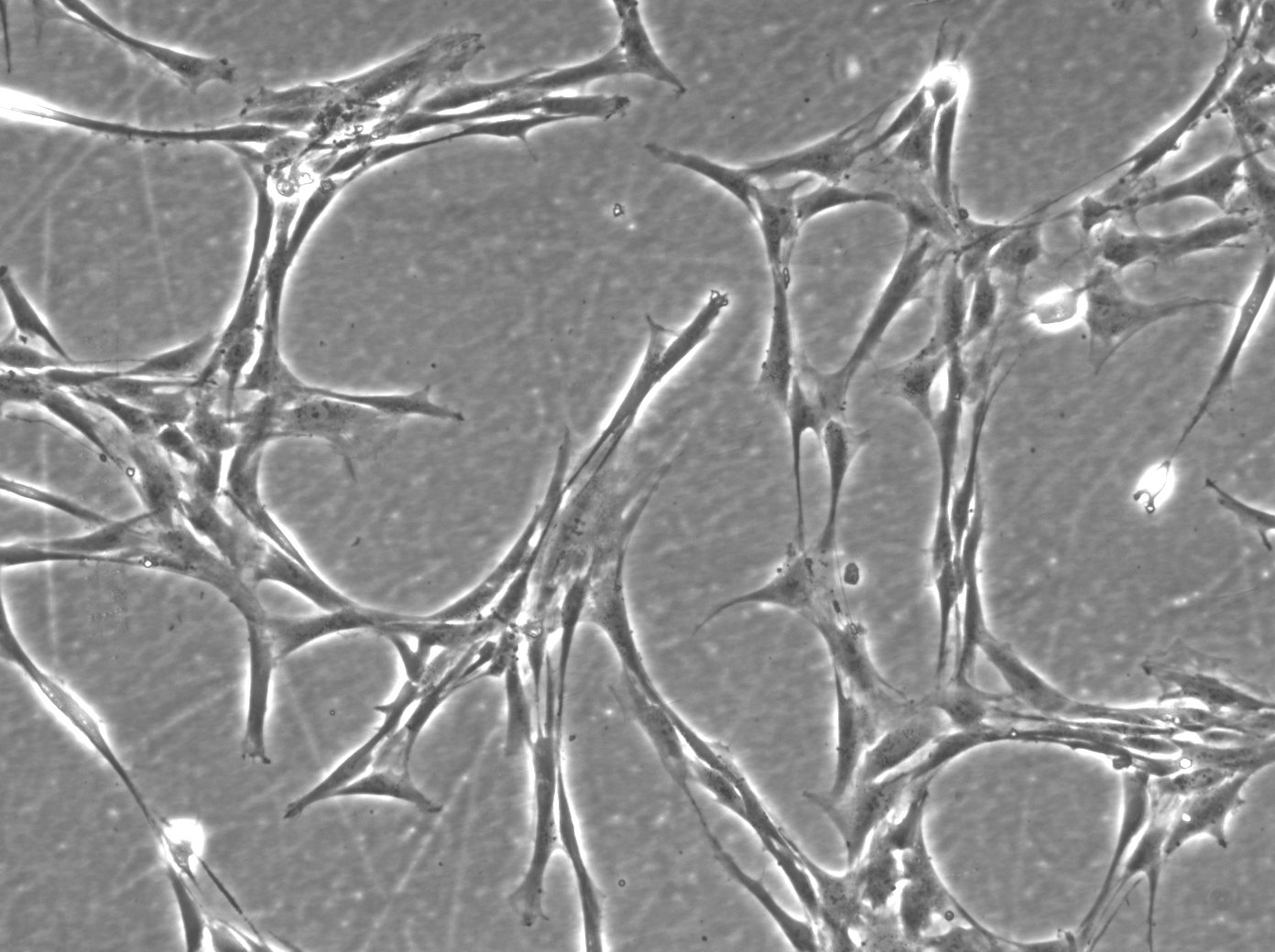 Menschliche Vorhaut-Fibroblasten-Zellen (HFFC)