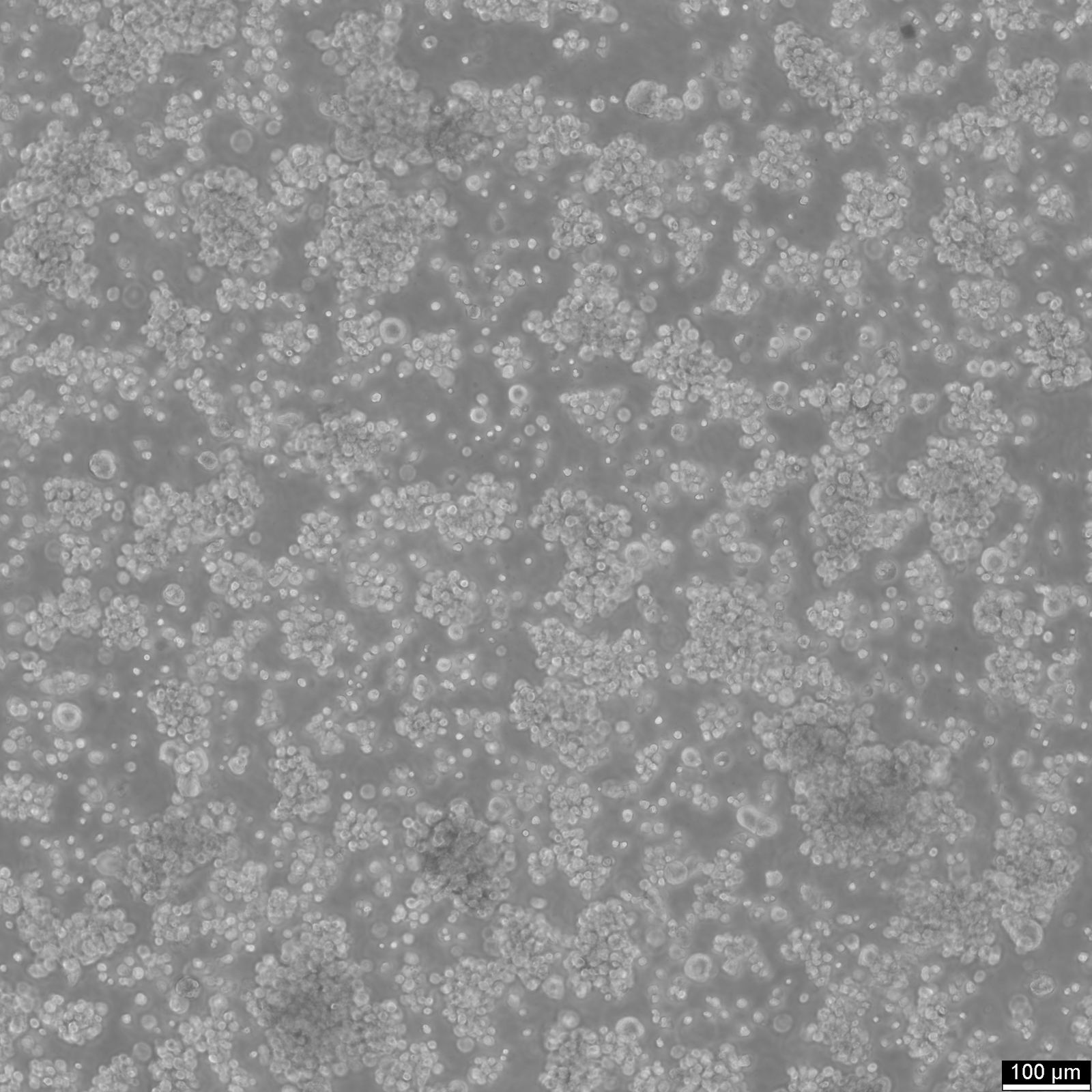 EB1 Cells EB1 Cells