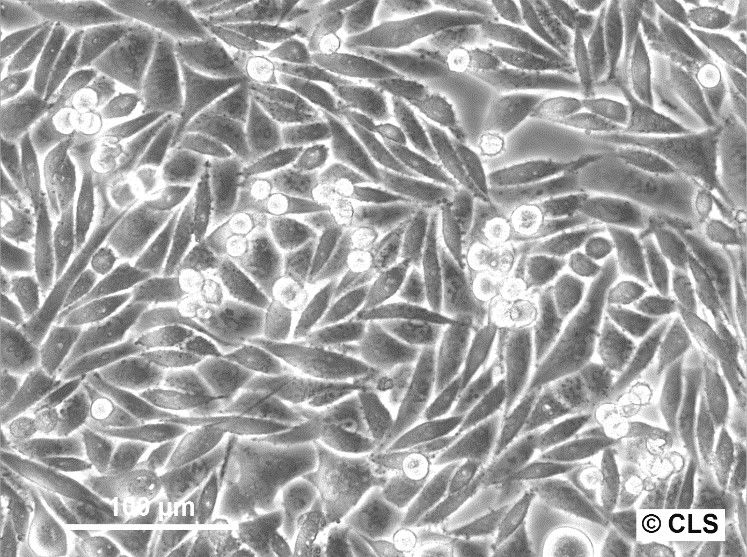 SK-UT-1 Cells