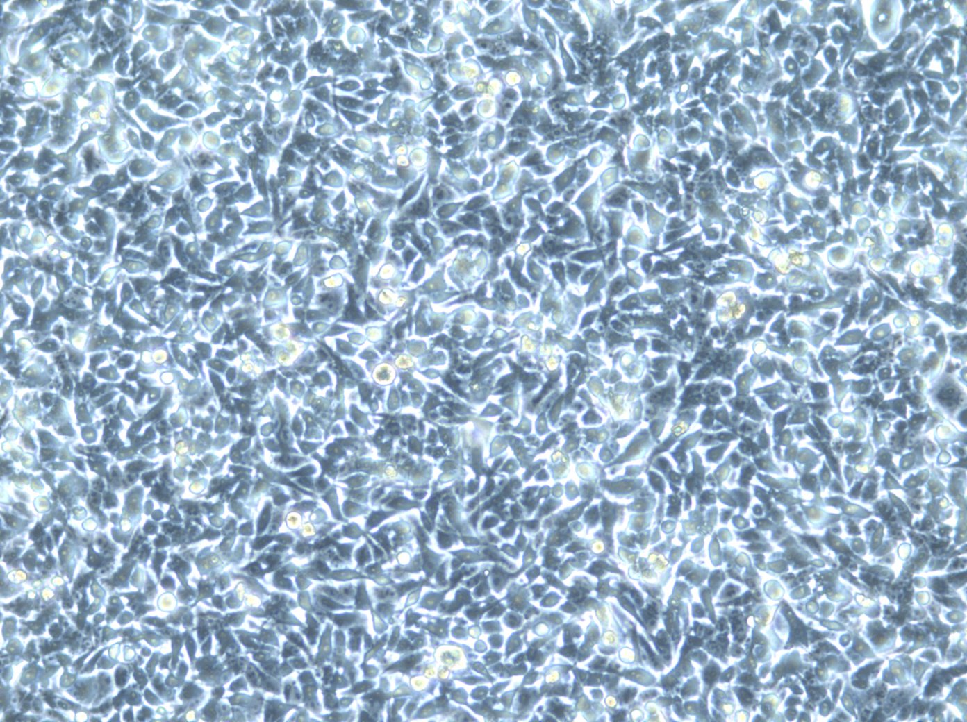 Cellules HK EGFP-LaminA/H2B-mCherry