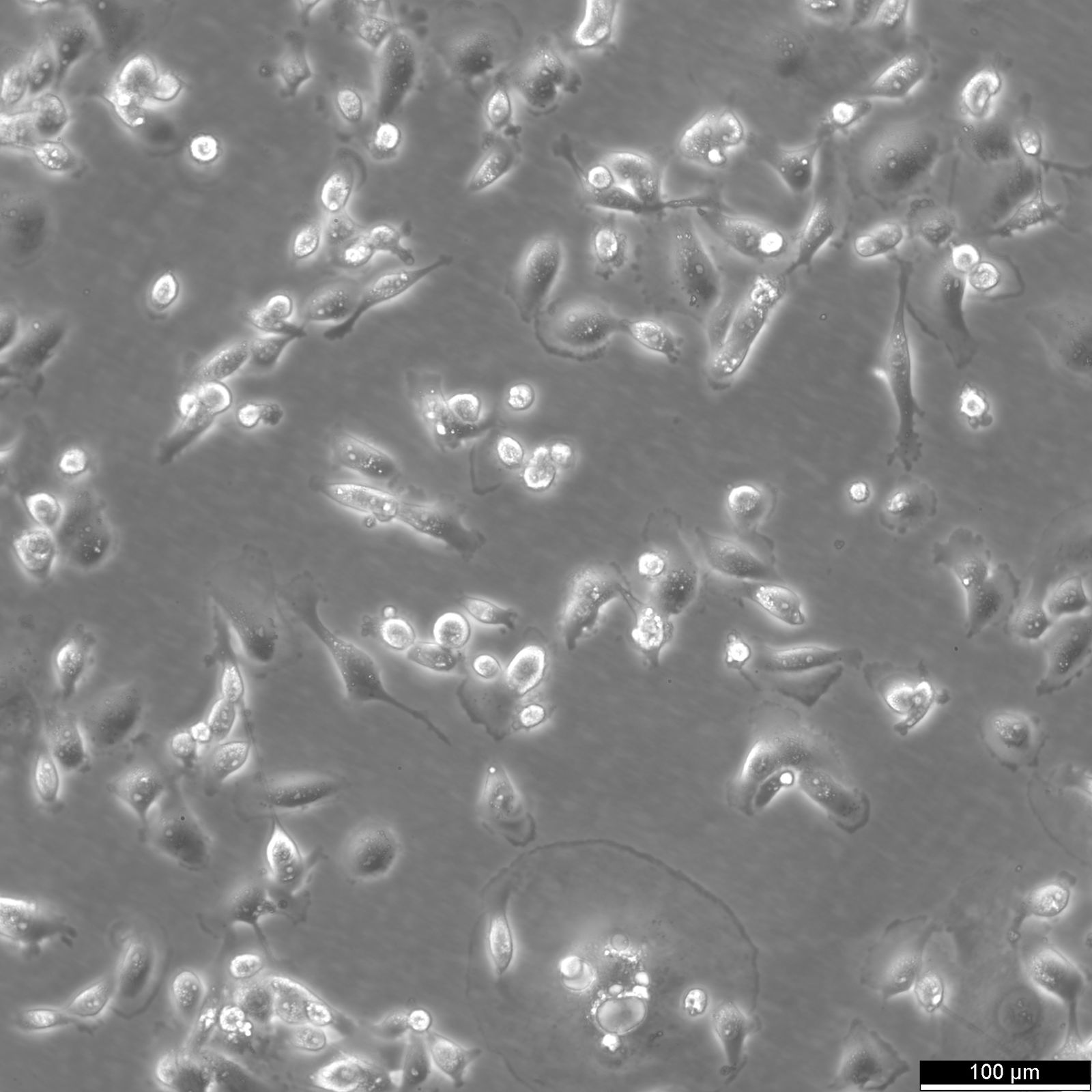 MDA-MB-231 Cells