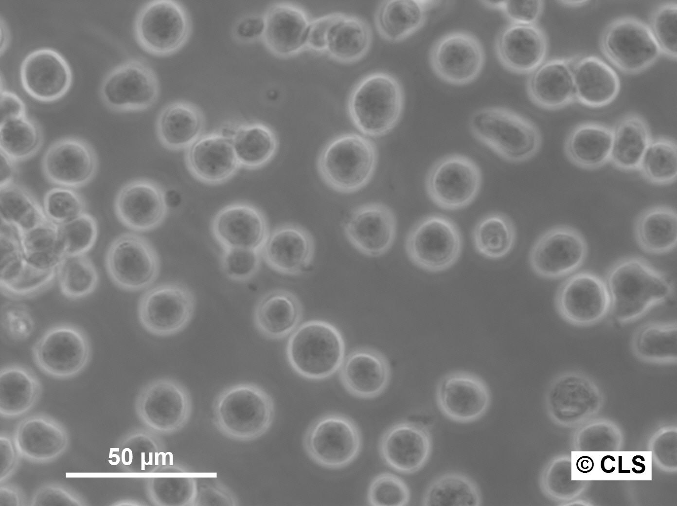 SKW-3 Cells SKW-3 Cells