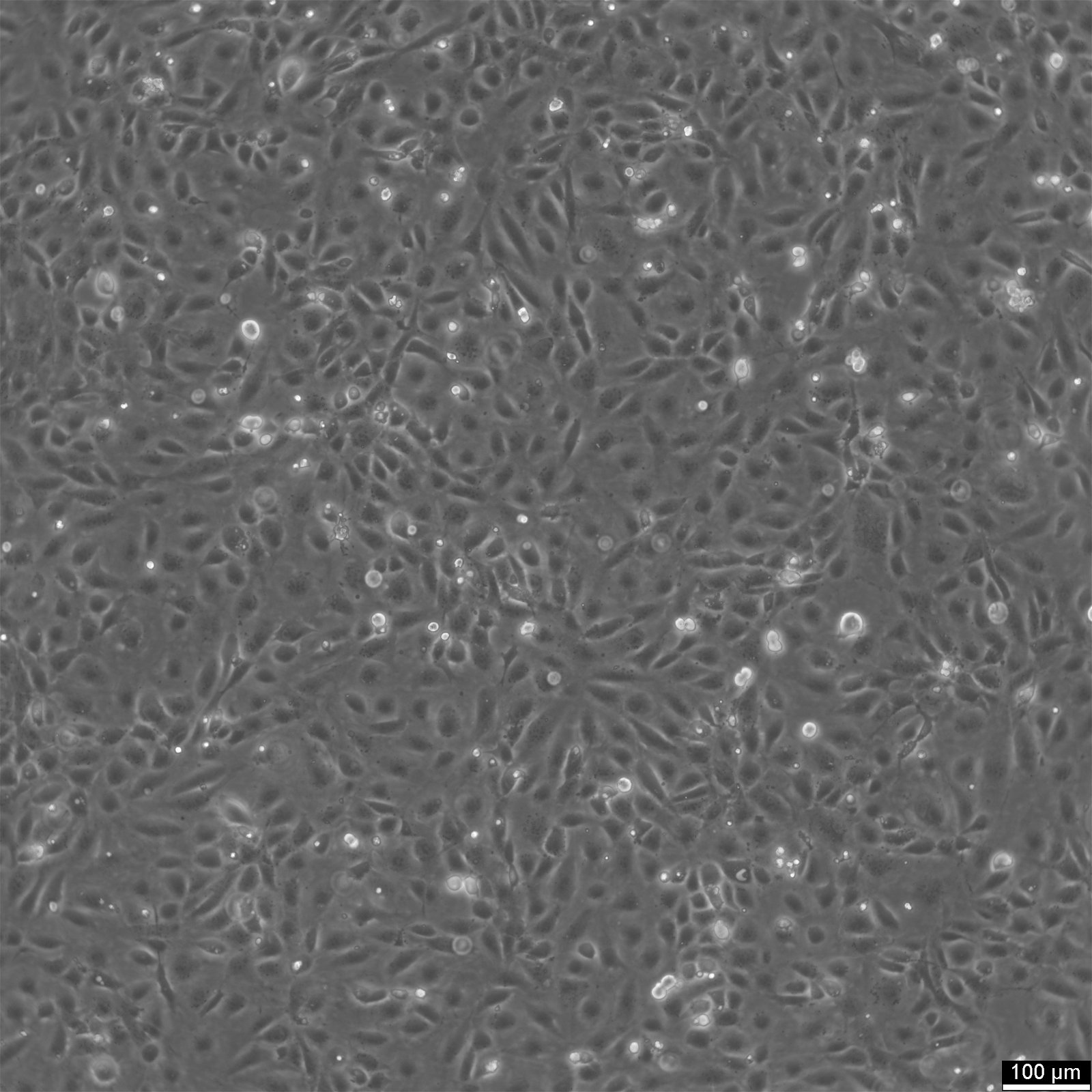 SVEC4-10 Cells