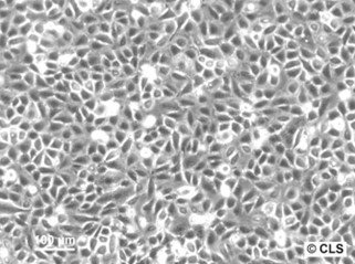 Cellules Chang Liver (HeLa)
