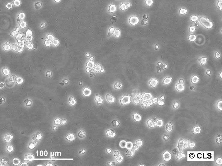 Cellules NS-1 (P3/NS/1-Ag4.1)