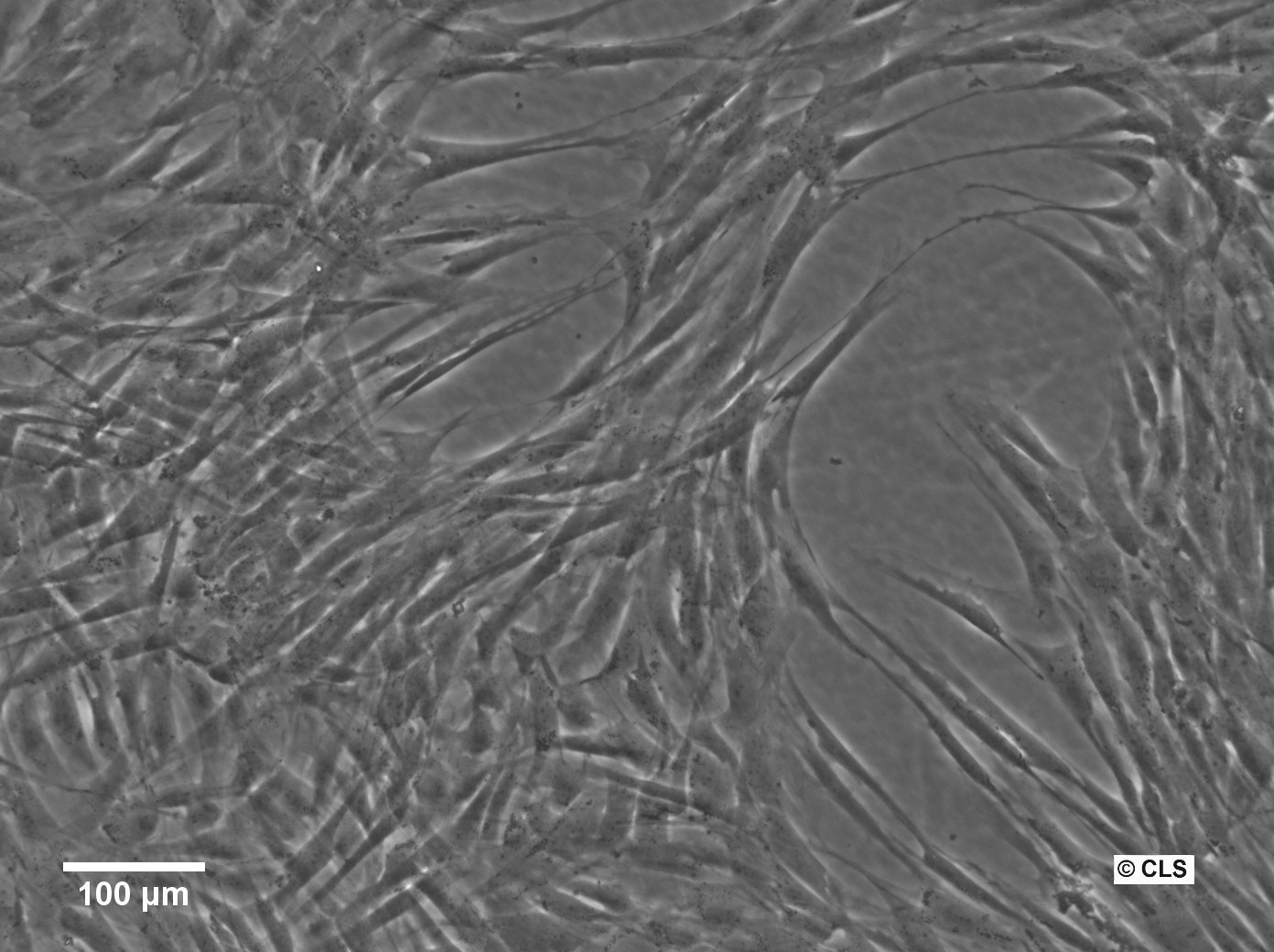 Menschliche Vorhaut-Fibroblasten-Zellen (HFFC)