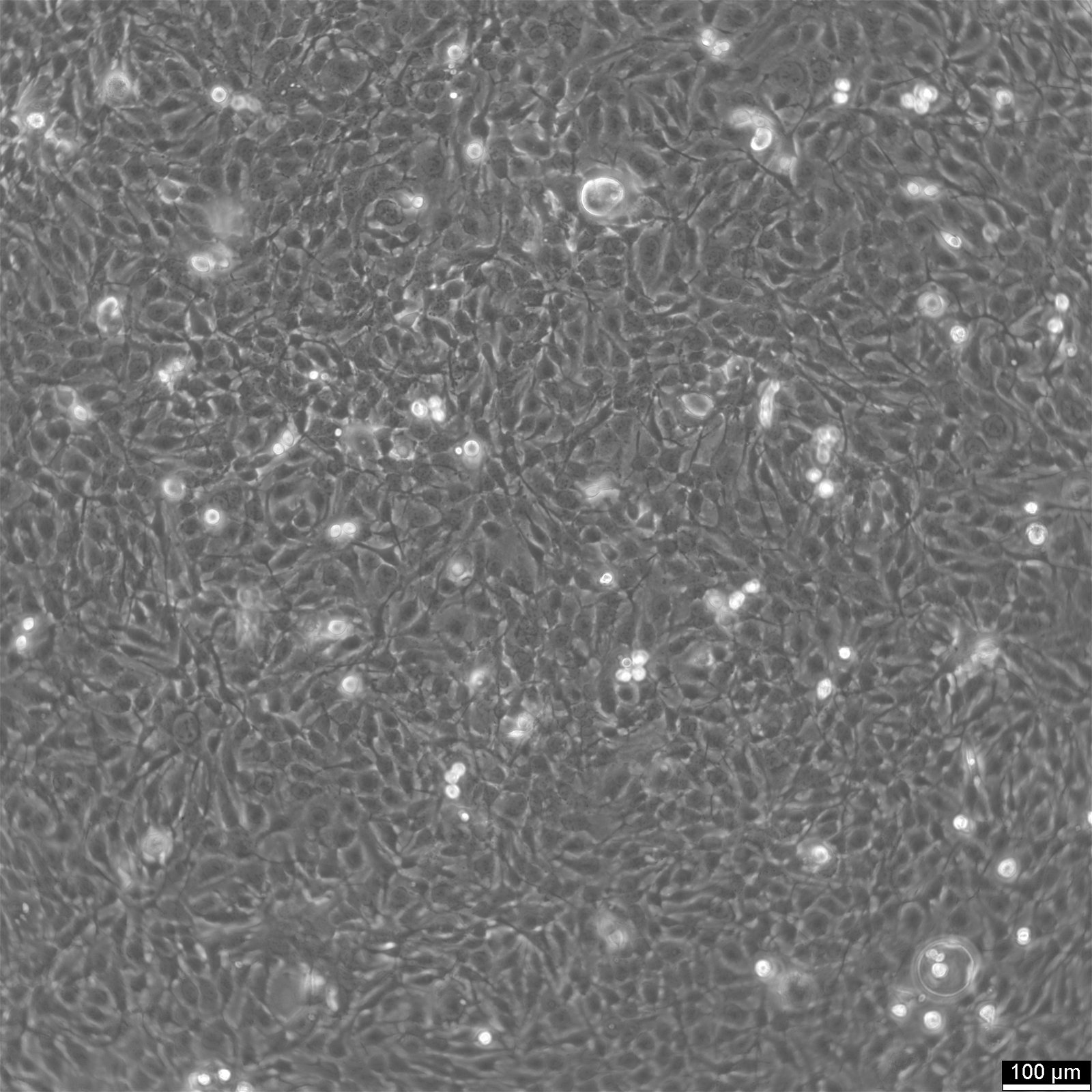 KYSE-410 Cells