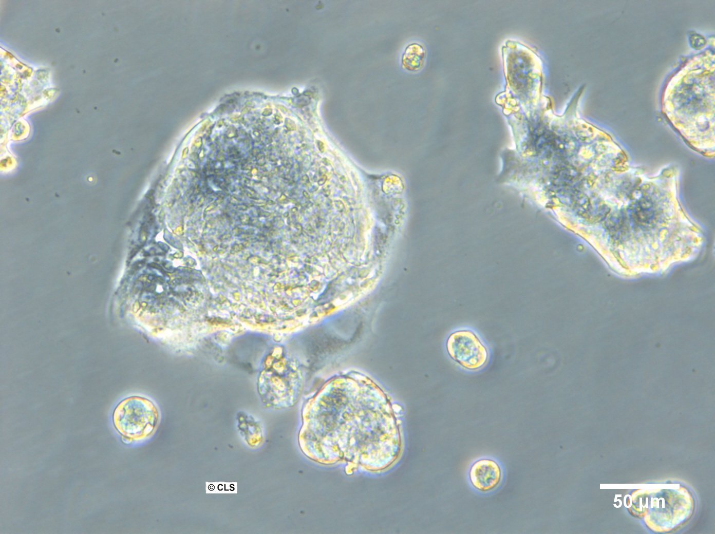 HROC147Met Cells