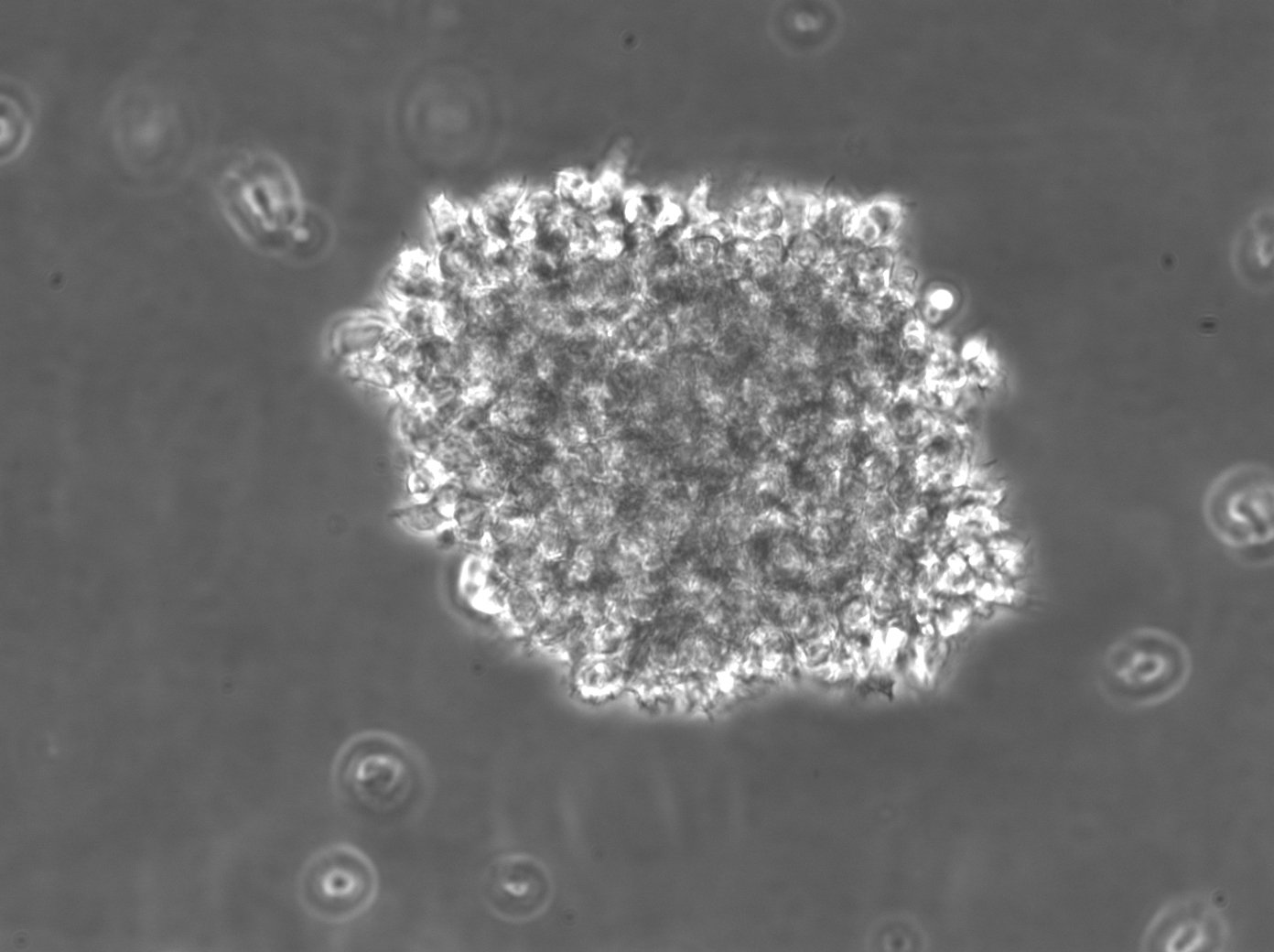 B-LCL-HROC10 Cells
