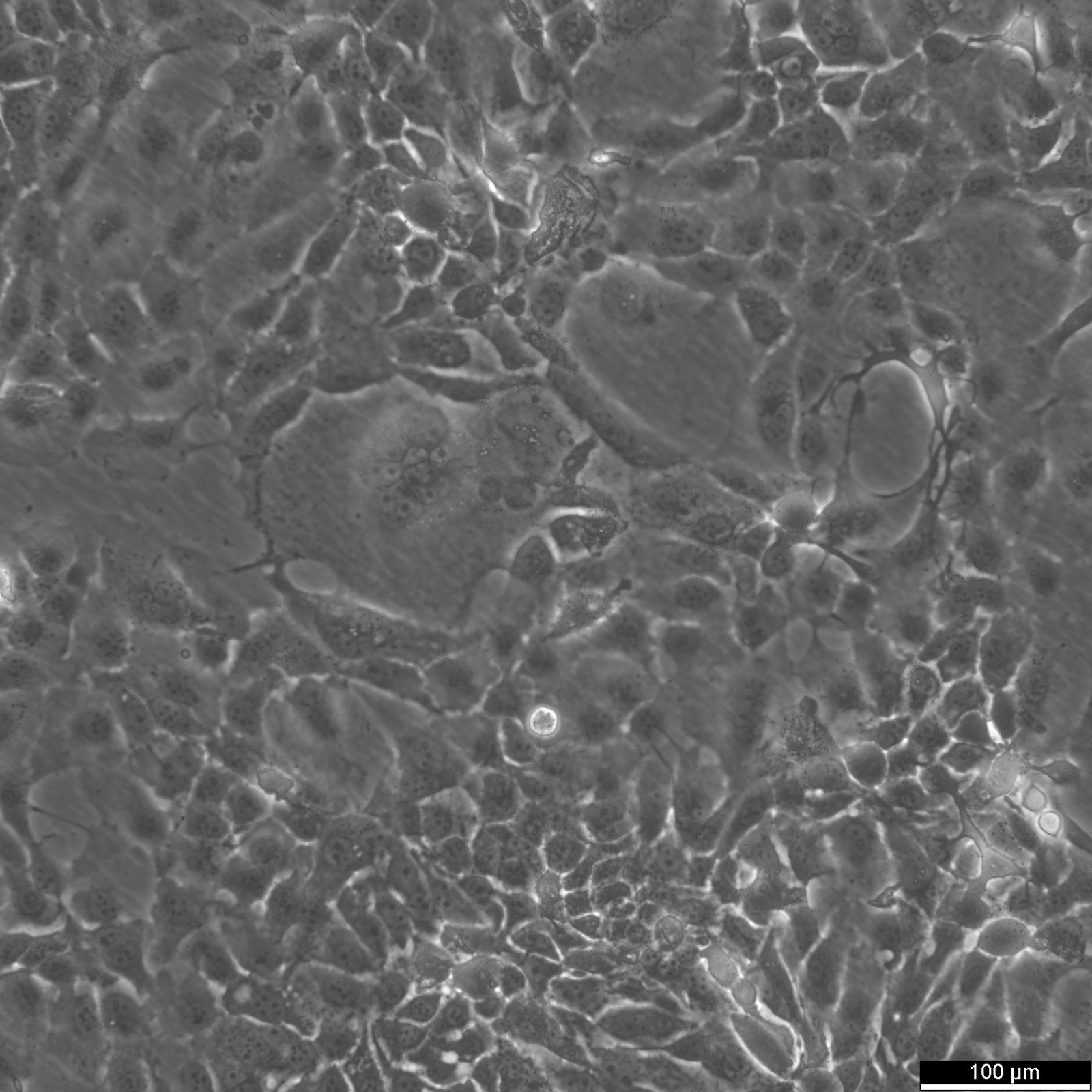 CLS-354 Cells CLS-354 Cells