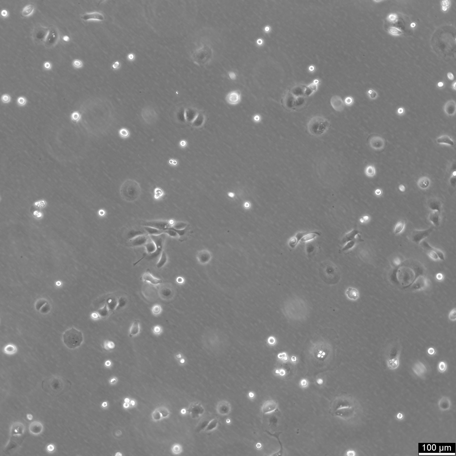 MKN-7 Cells